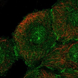 anti-CLCA2, Polyclonal, Novus Biologicals 0.1mL; Unlabeled:Antibodies,